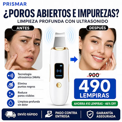 Espátula Ultrasónica Facial GUGUG – Limpiador Profundo + Removedor de Impurezas SkinClean Pro – Espátula Ultrasónica Facial
